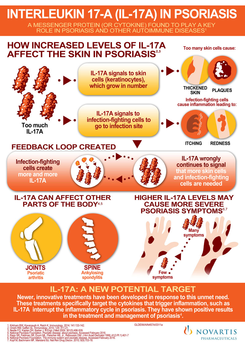 Novartis Infographic for 90TEN, centered on Psoriasis